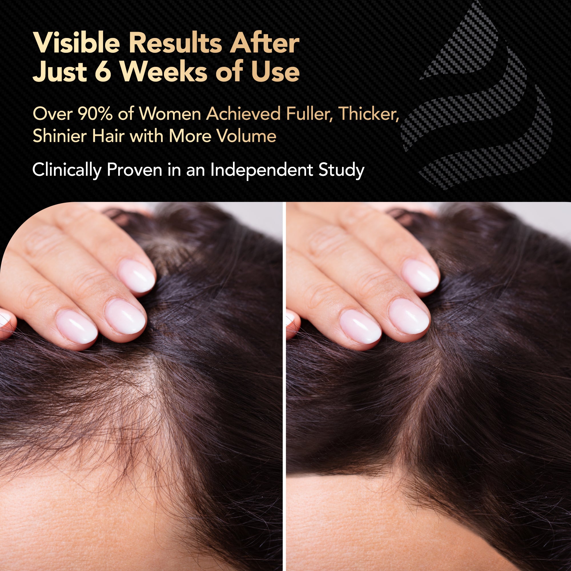 Dicktails Haarwachstum und Stärkung von Vitaminen | 90 Kapseln | 1 Monat Angebot