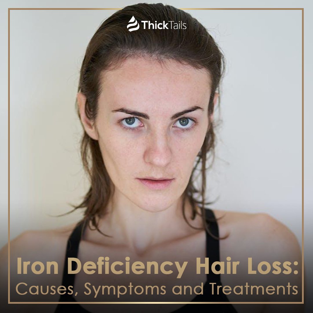 Iron Deficiency Hair Loss: Causes, Symptoms and Treatments | ThickTails