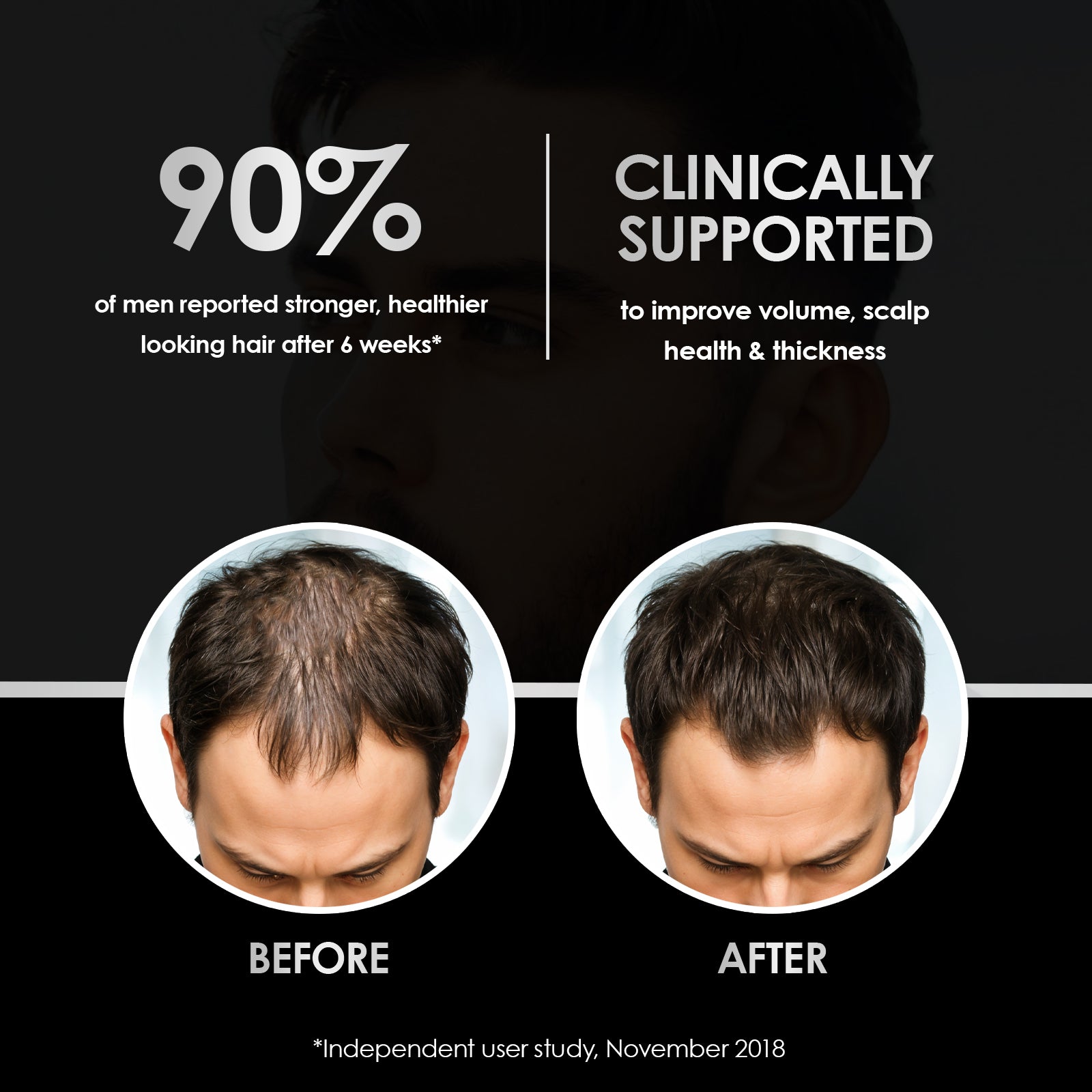 TickTails menns stimulerende hårvekstsjampo og balsam | Dual Pack