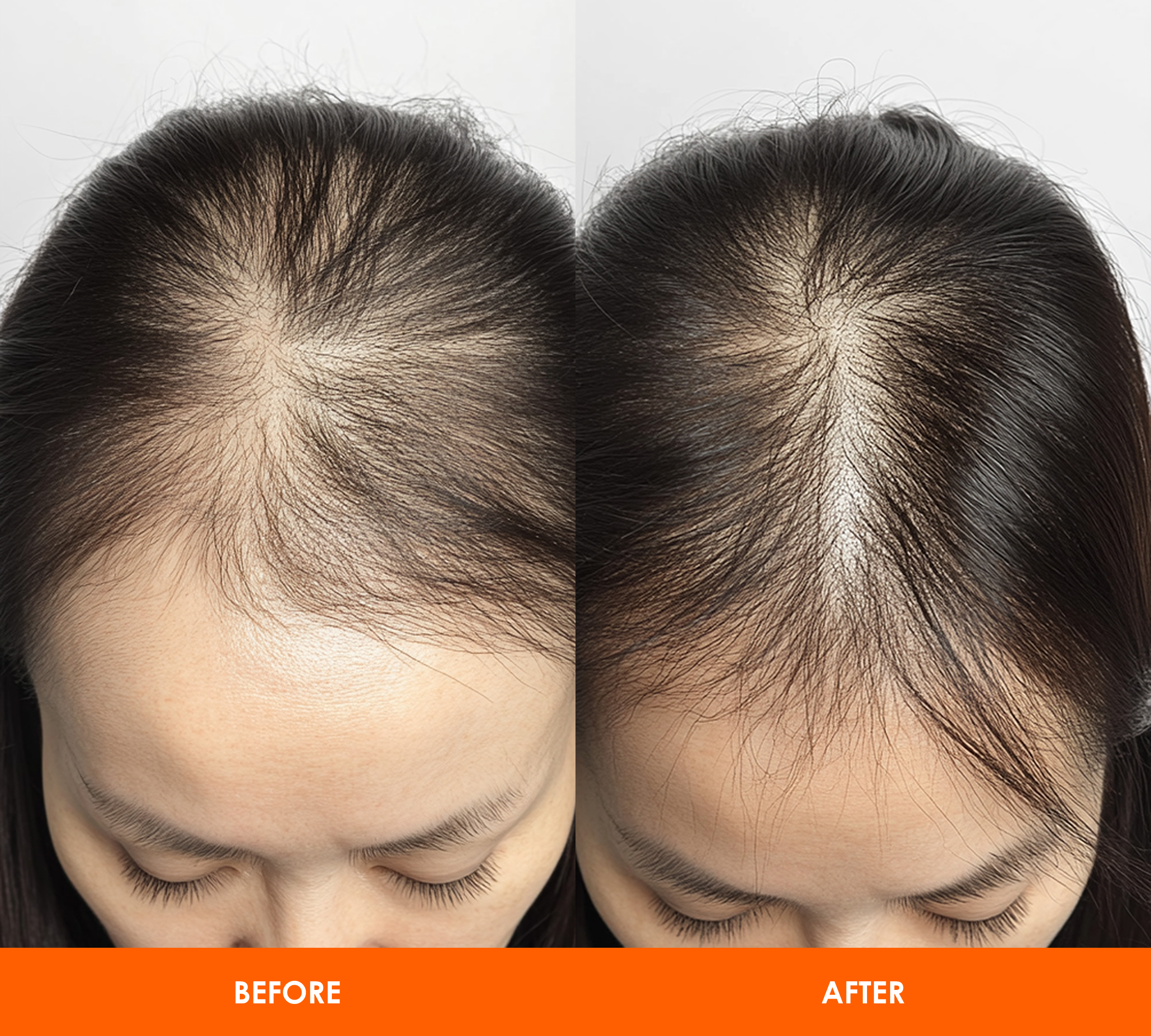 Group 36.png__PID:371aa33e-ff33-42a9-9613-bc831cc5b37f